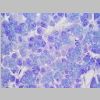 Pancreas SF 08.jpg